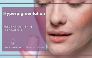 Hyperpigmentation: Prevention, Skin Treatments