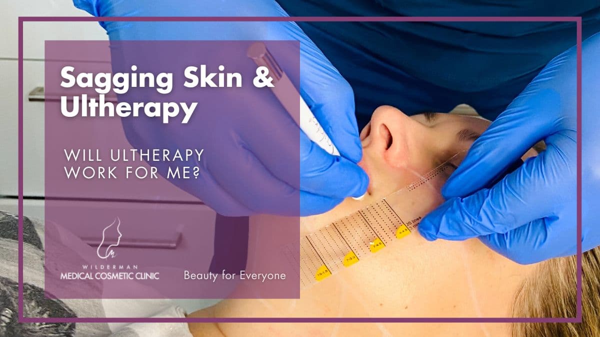 Sagging Skin & Ultherapy - Will Ultherapy work for me?