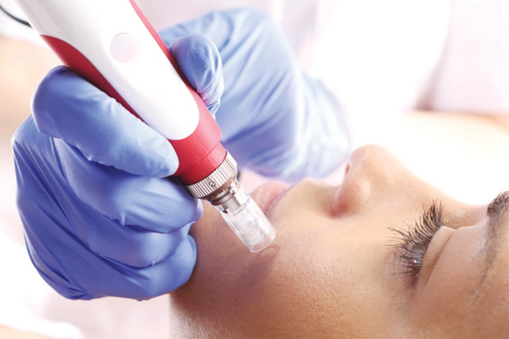 Skincare specialist injecting vitamins during a Mesotherapy procedure