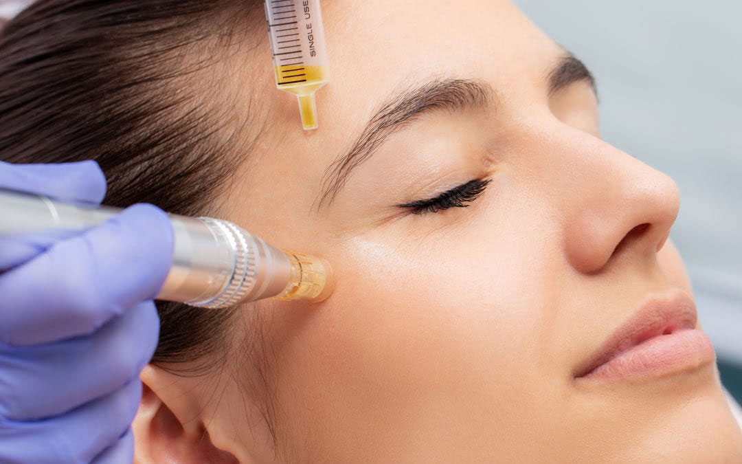 Skincare specialist performing PRP and PRF on woman face