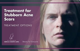 Treatment for Stubborn Acne Scars: Treatment options