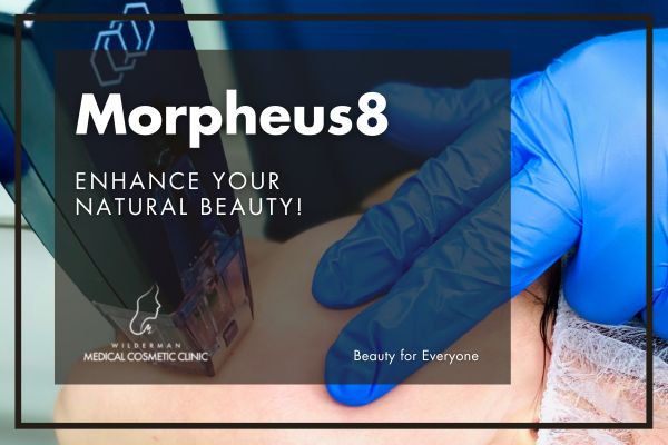 Morpheus8 for Acne Treatment - Woman under treatment
