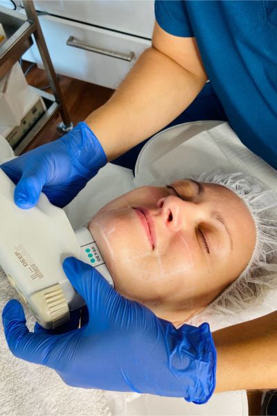 Image of a patient receiving Ultherapy treatment.