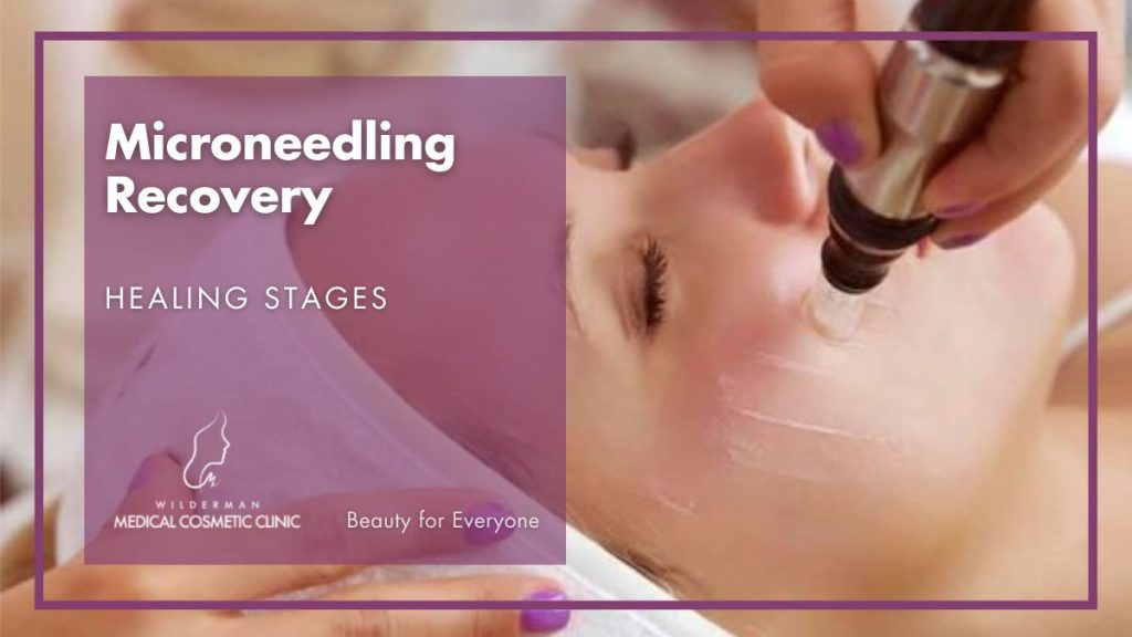 Microneedling Recovery – Healing Stages
