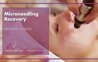 Microneedling Recovery: Healing Stages