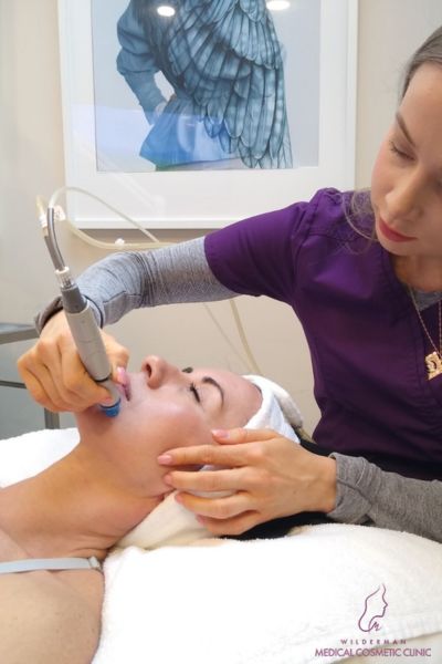 hydrafacial treatment in Wilderman Cosmetic Clinic - A photo of a patient getting Hydrafacial at our Medical Cosmetic Clinic
