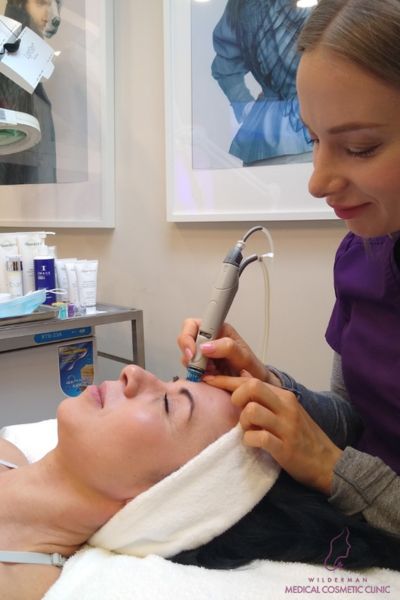 hydrafacial treatment in Wilderman Cosmetic Clinic - A picture of a patient getting Hydrafacial at our Medical Cosmetic Clinic