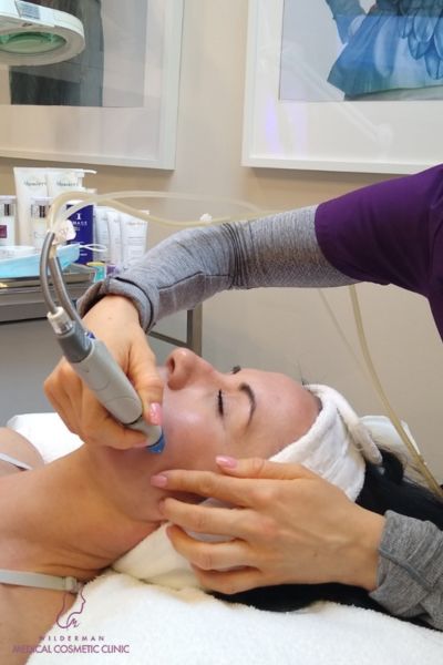 Hydrafacial procedure viktorija - Picture of a patient receiving the treatment on Wilderman Cosmetic Clinic