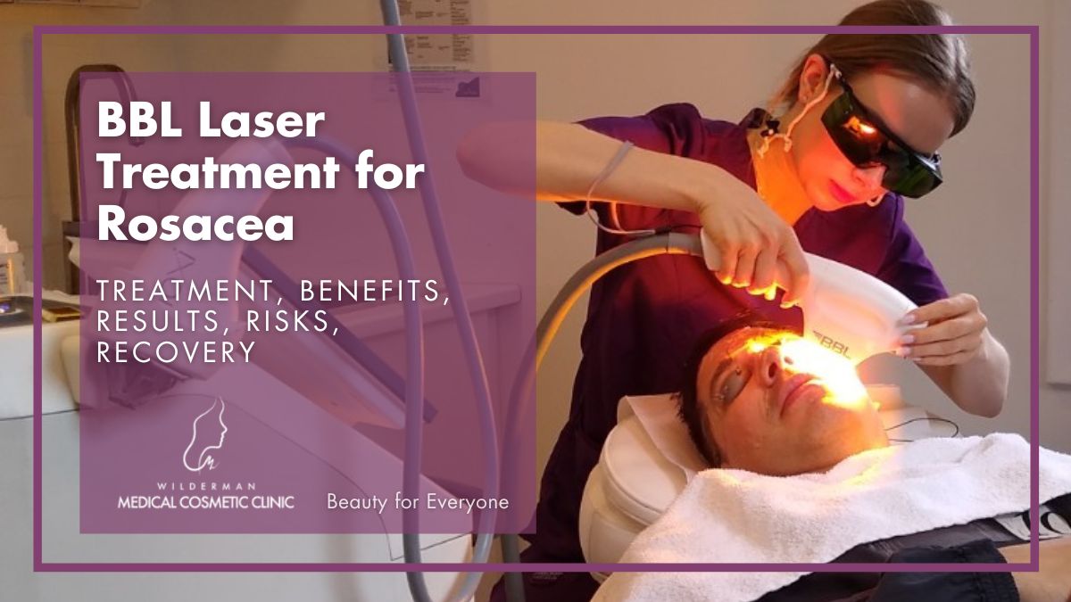 BBL Laser Treatment for Rosacea: Treatment, Benefits, Results, Risks, Recovery