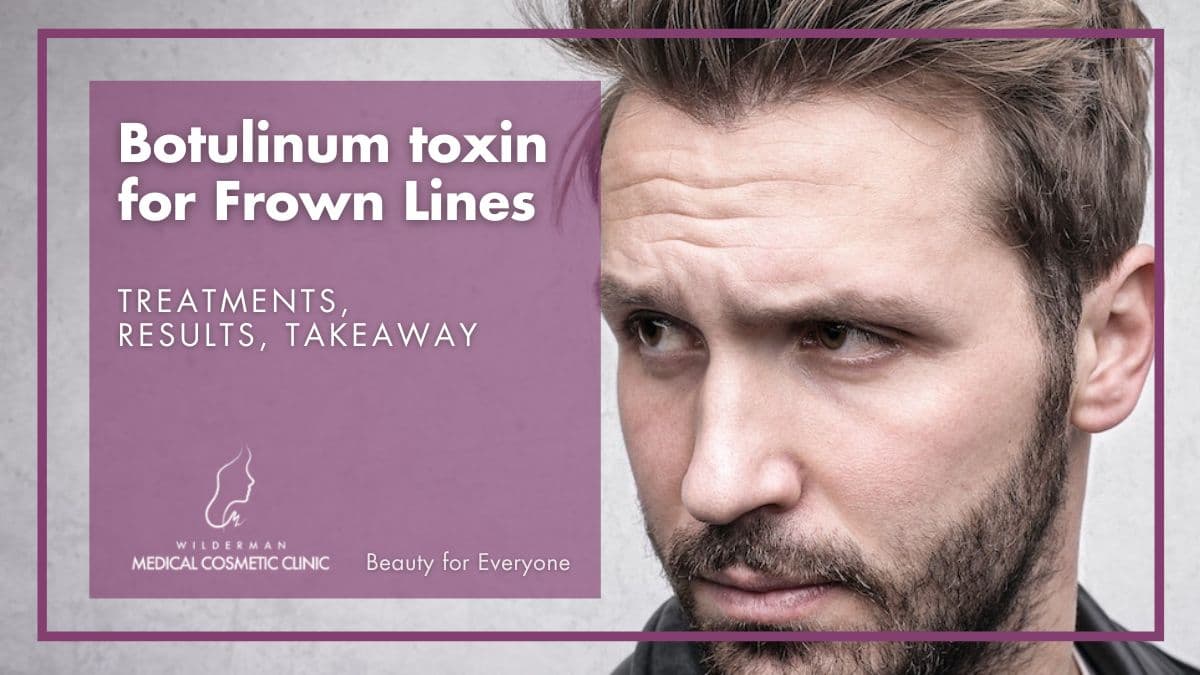 Botulinum toxin for Frown Lines: Treatments, Results, Takeaway