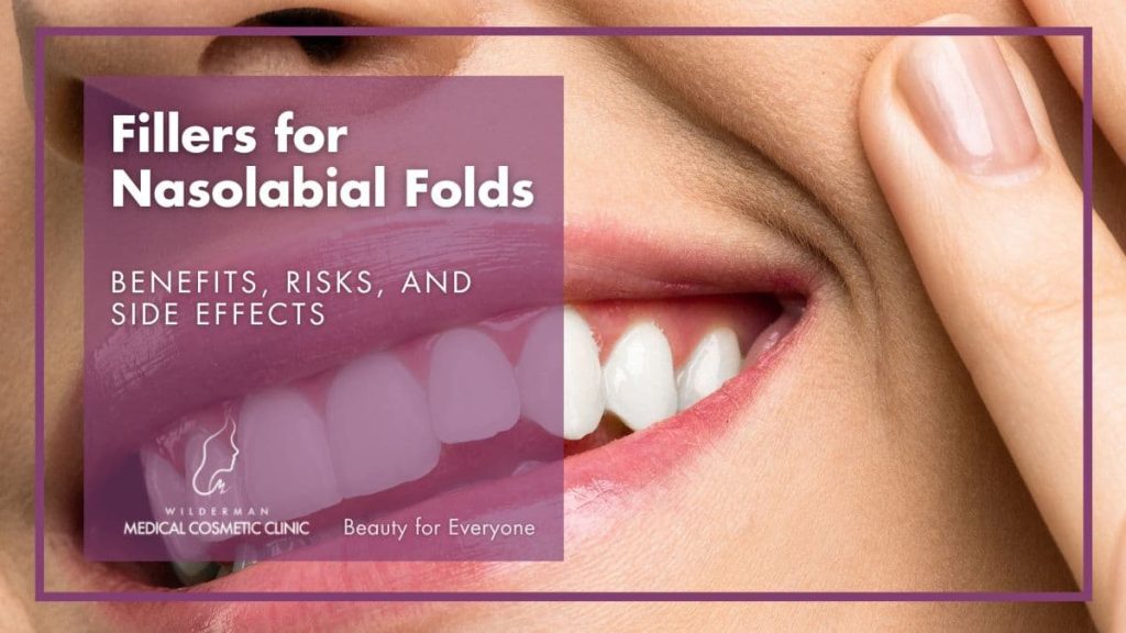 Fillers for Nasolabial Folds - Wilderman Cosmetic Clinic