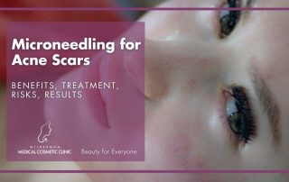 Microneedling for Acne Scars: Benefits, Treatment, Risks, Results