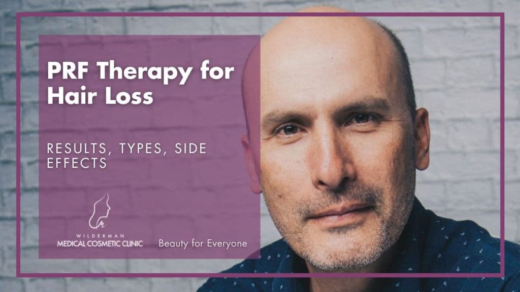 PRF Therapy for Hair Loss: Results, Types, Side Effects