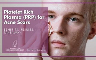 Platelet Rich Plasma (PRP) for Acne Scars: Benefits, Results, Takeaway