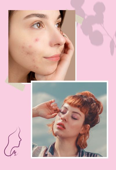 Skin Conditions - Wilderman Medical Cosmetic Clinic