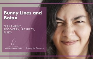 Bunny Lines and Botulinum Toxin: Treatment, Recovery, Results, Risks