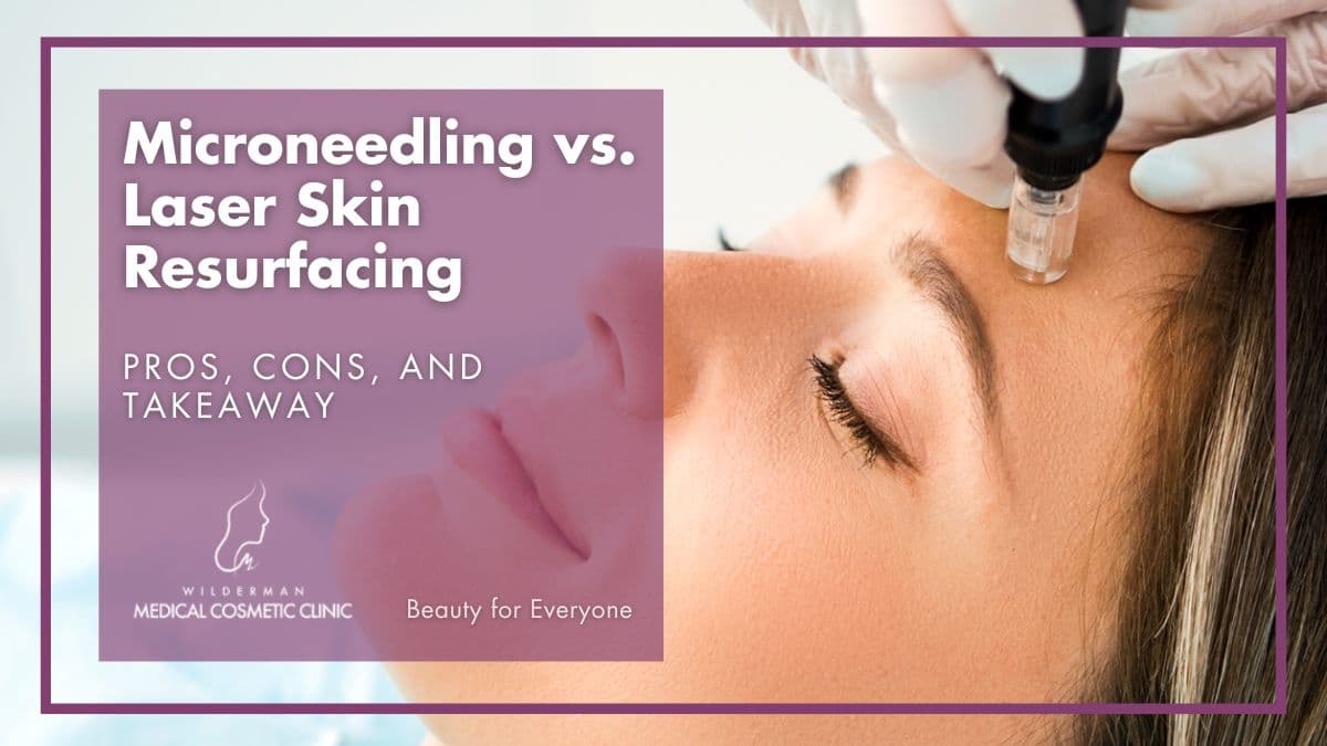 Microneedling vs. Laser Skin Resurfacing: Pros, Cons, and Takeaway - Wilderman Medical Cosmetic Clinic