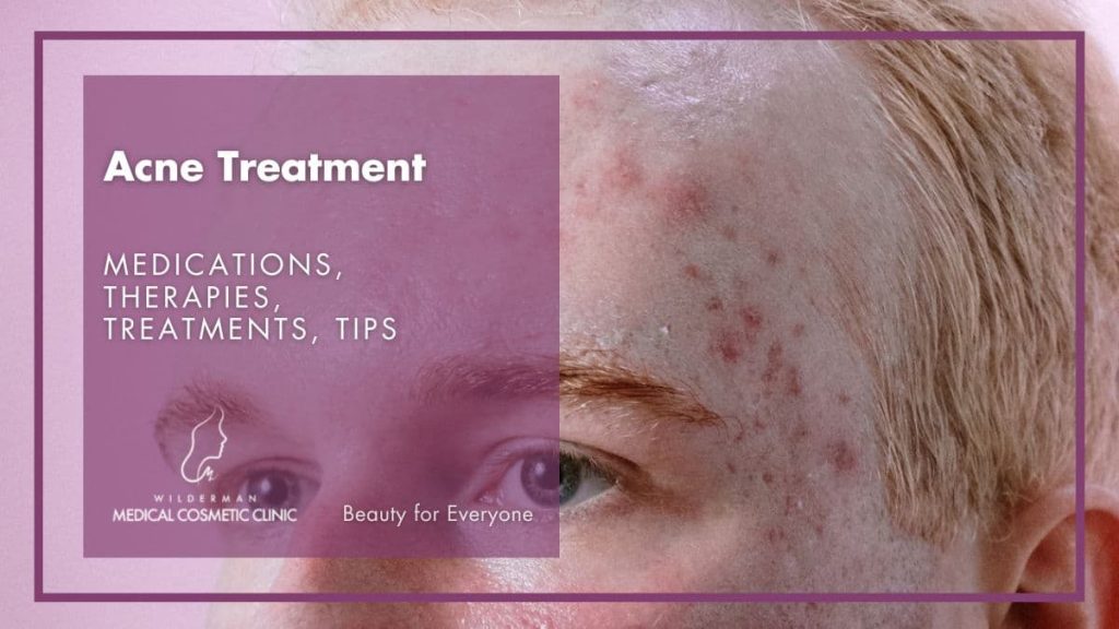 Acne Treatment: Medications, Therapies, Treatments, Tips