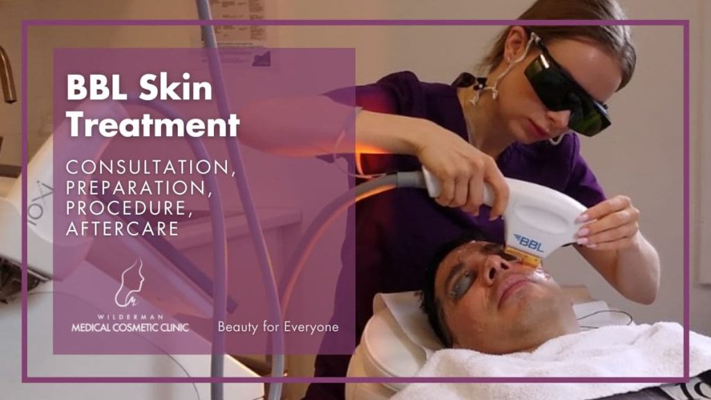 What to expect from BBL skin treatment? | Wilderman Cosmetic Clinic 