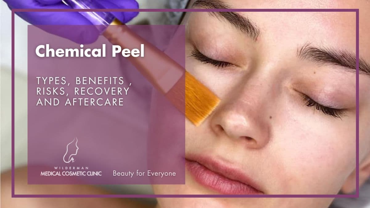 Chemical Peel - A Non-invasive skin rejuvenation - A woman receiving Chemical Peel treatment