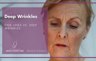 Deep Wrinkles: Fine Lines vs. Deep Wrinkles