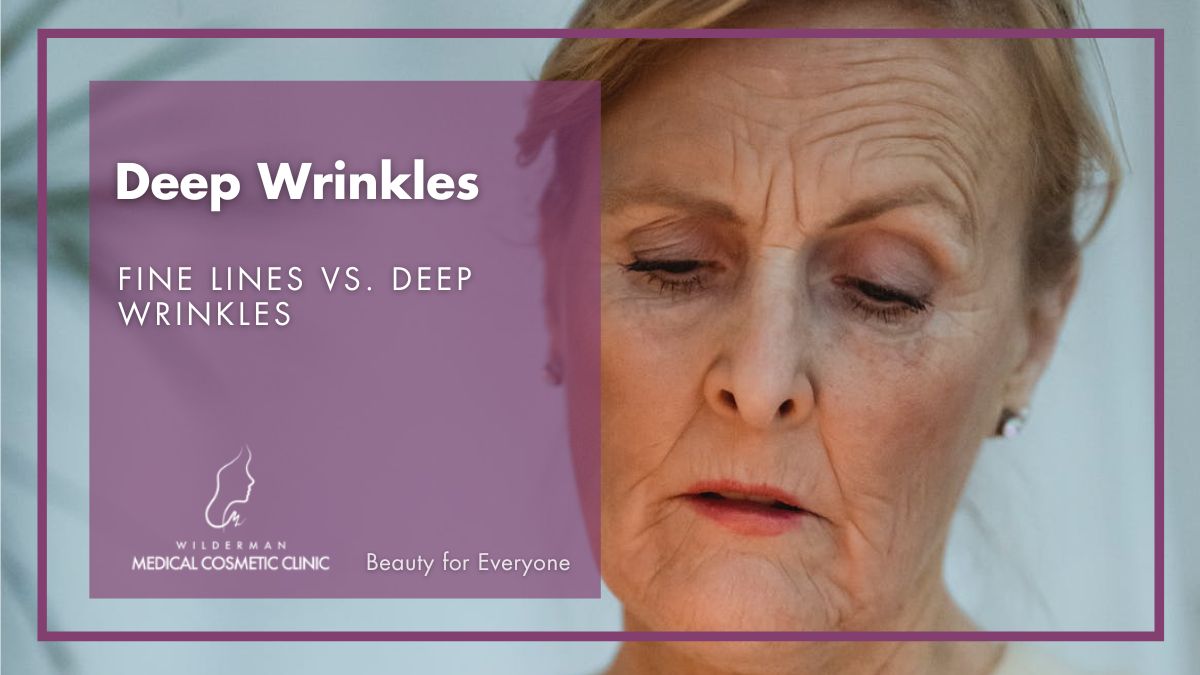 Fine Lines vs. Deep Wrinkles