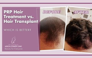 PRP Hair Treatment vs. Hair Transplant: Which is Better?