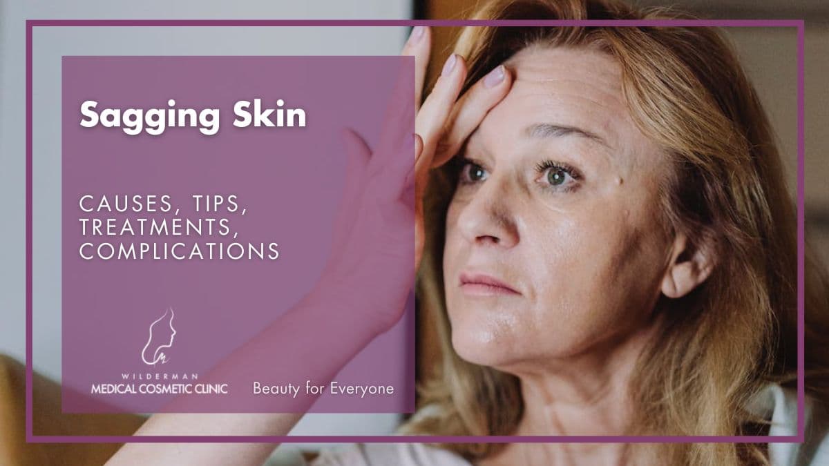 Sagging Skin - Causes, Treatment, Prevention