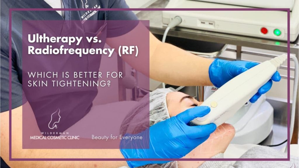 Ultherapy vs. Radiofrequency (RF) Skin Tightening | Wilderman Cosmetic Clinic 