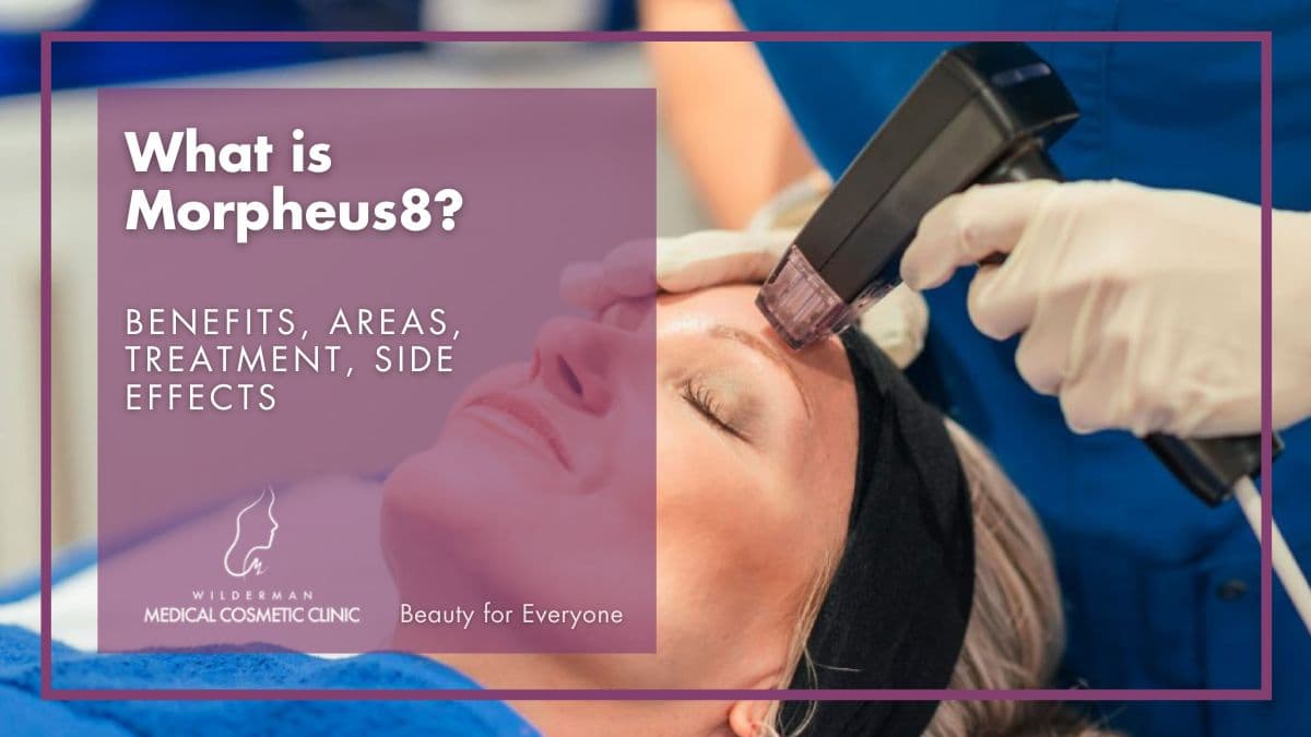 Resurface & remodel your face and body with Morpheus8 - Photo of a patient receiving Morpheus8 by Dr Arsh in our Cosmetic Clinic.