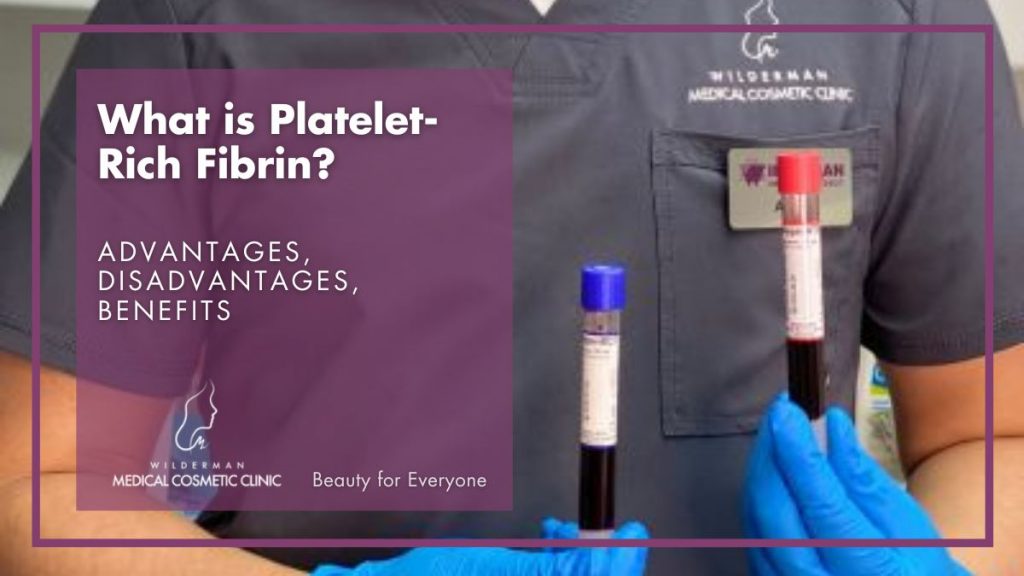 Platelet-Rich Fibrin (PRF) - A second generation PRP