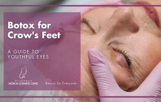 Botox for Crow’s Feet: A Guide to Youthful Eyes