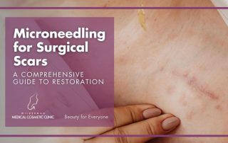Microneedling for Surgical Scars