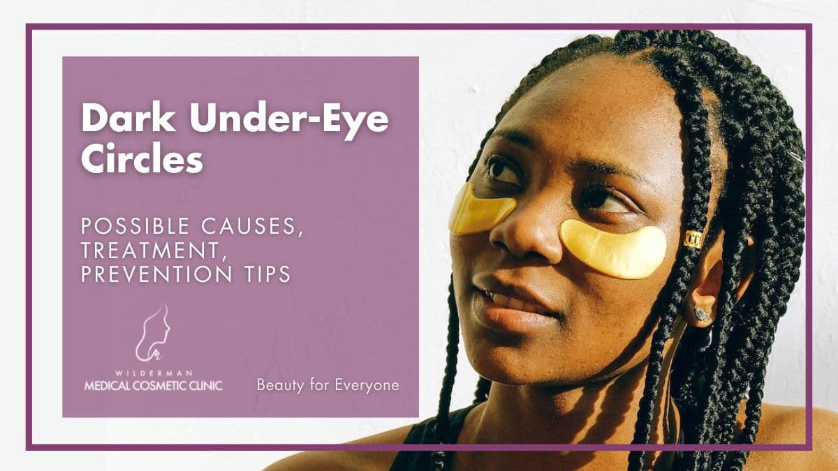 Dark Under-Eye Circles: Possible Causes, Treatment, Prevention Tips - Wilderman Medical Cosmetic Clinic