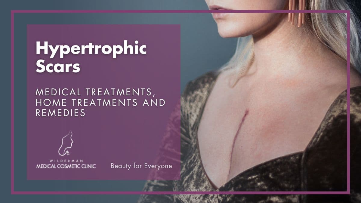 Hypertrophic Scars: Medical treatments, Home treatments and remedies | Wilderman Cosmetic Clinic