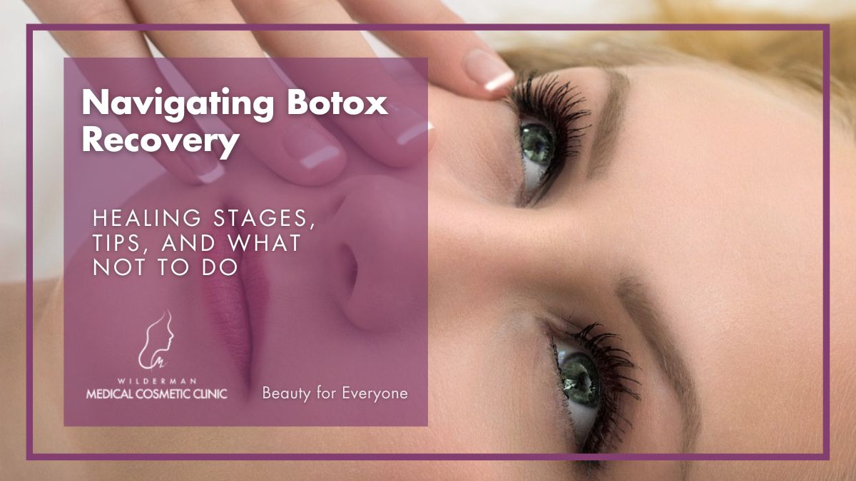 Navigating Botox Recovery: Healing Stages, Tips, and What Not to Do
