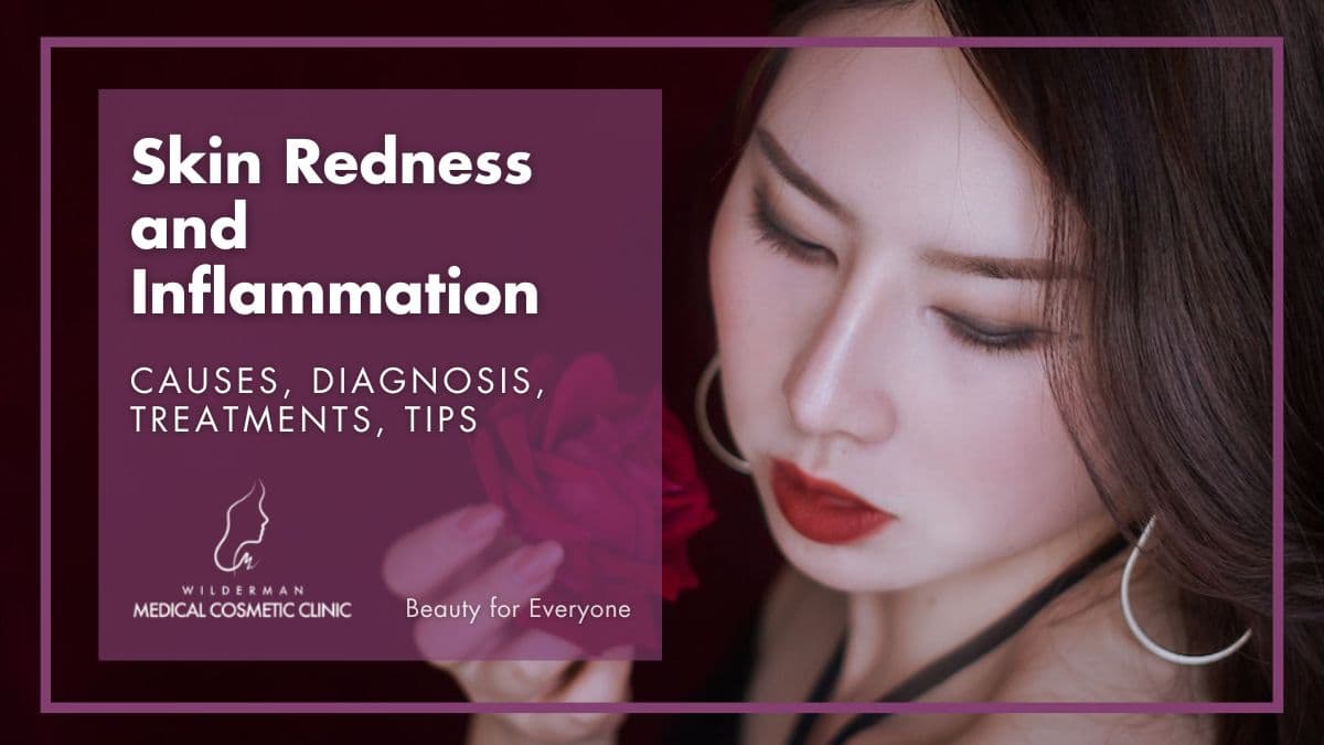 Skin Redness and Inflammation: Causes, Diagnosis, Treatments, Tips | Wilderman Cosmetic Clinic