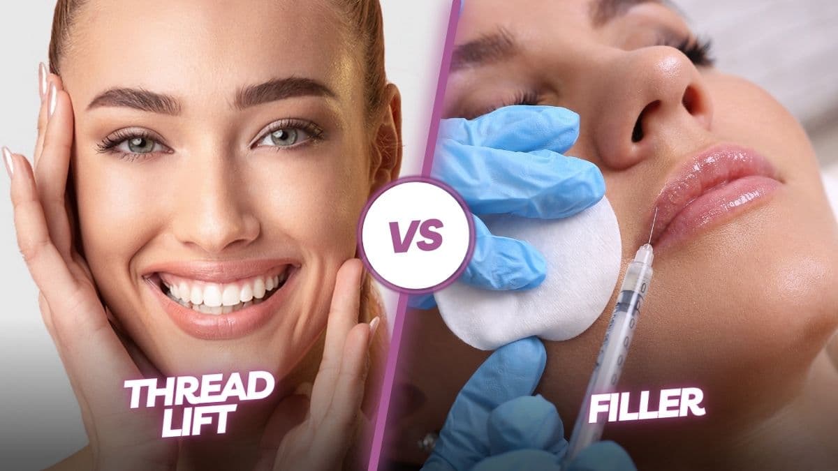 Thread Lift vs. Filler - Wilderman Cosmetic Clinic