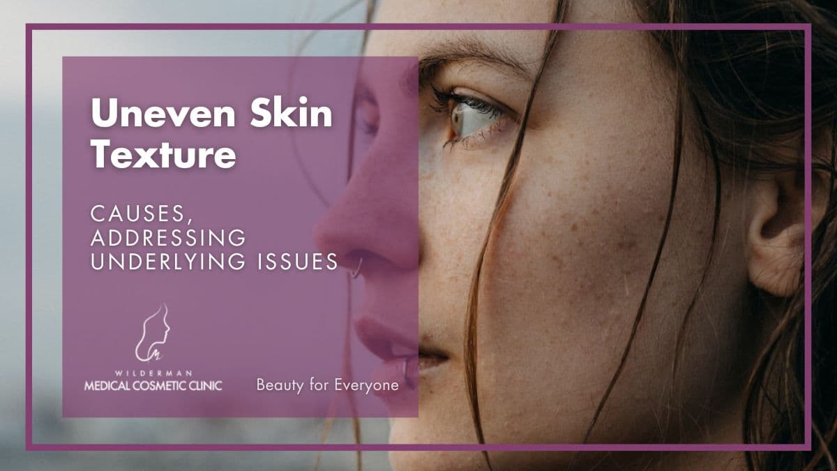 Uneven Skin Texture: Causes, Addressing Underlying Issues | Wilderman Cosmetic Clinic