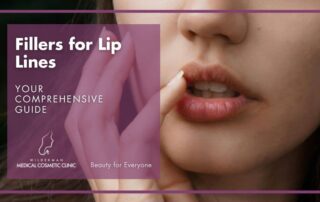 Fillers for Lip Lines: Your Comprehensive Guide