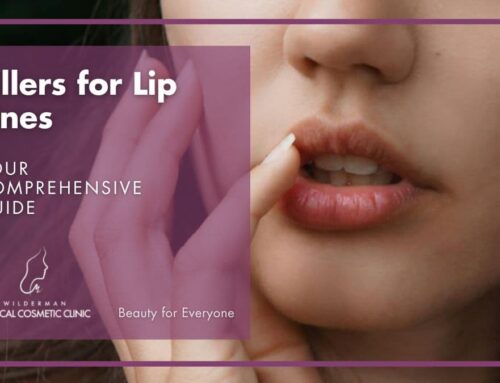 A Comprehensive Guide to Fillers for Lip Lines
