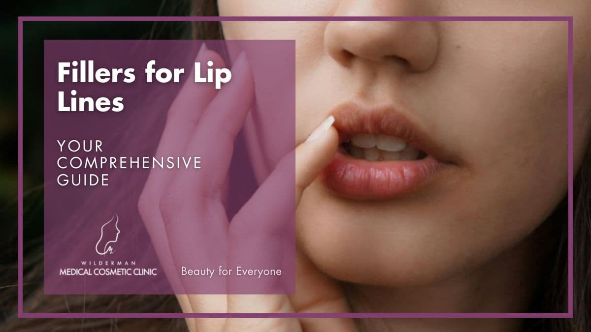 Fillers for Lip Lines: Your Comprehensive Guide - Wilderman Cosmetic Clinic