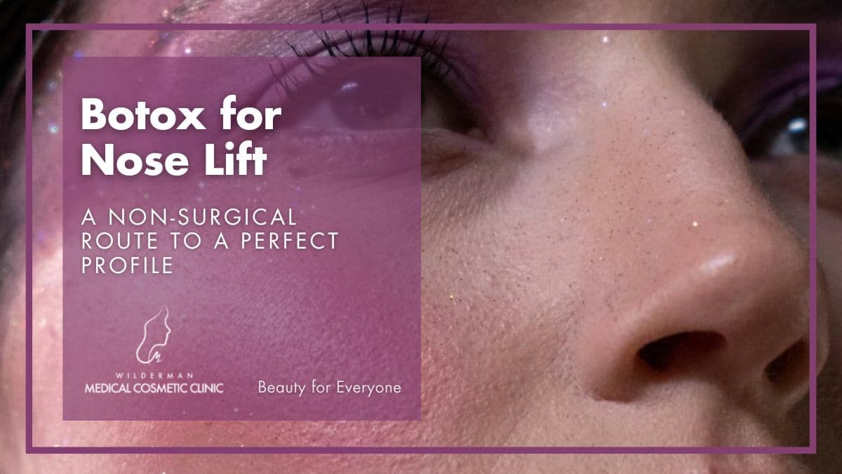 Botox for Nose Lift : Non-Surgical Route to a Perfect Profile - Wilderman Cosmetic Clinic