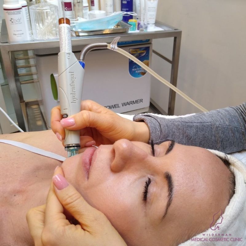 Hydrafacial Treatments - Wilderman Cosmetic Clinic