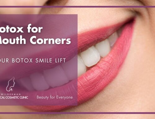 Botox for Mouth Corners: Botox Smile Lift