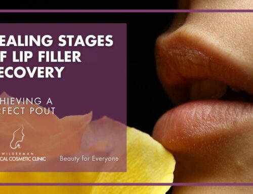 Healing Stages of Lip Filler Recovery