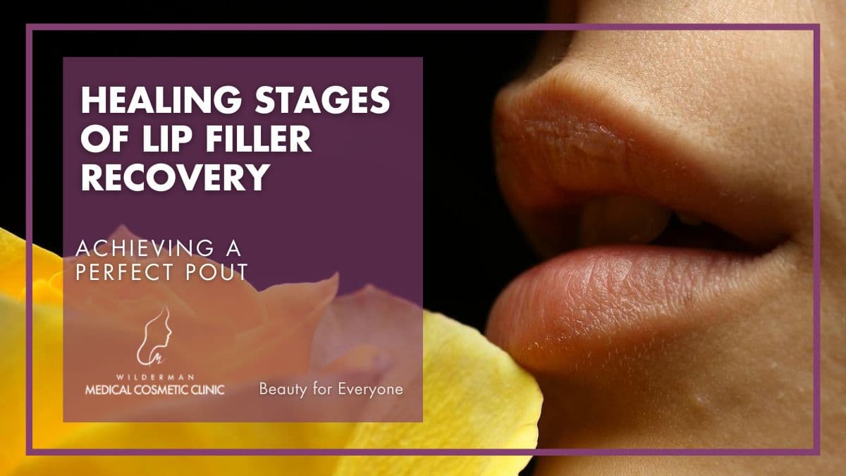 HEALING STAGES OF LIP FILLER RECOVERY: Achieving a Perfect Pout - Wilderman Cosmetic Clinic