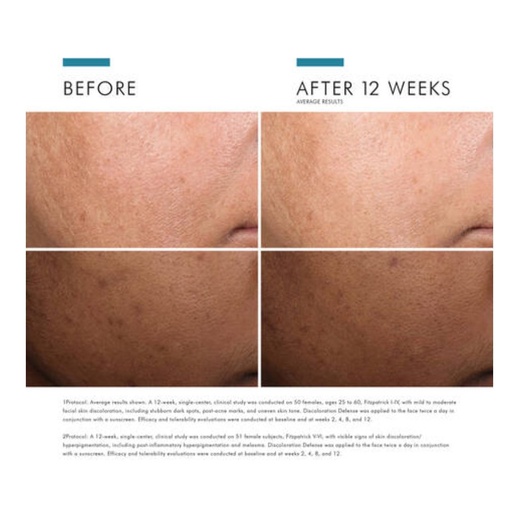 Discoloration Defense - Image 6