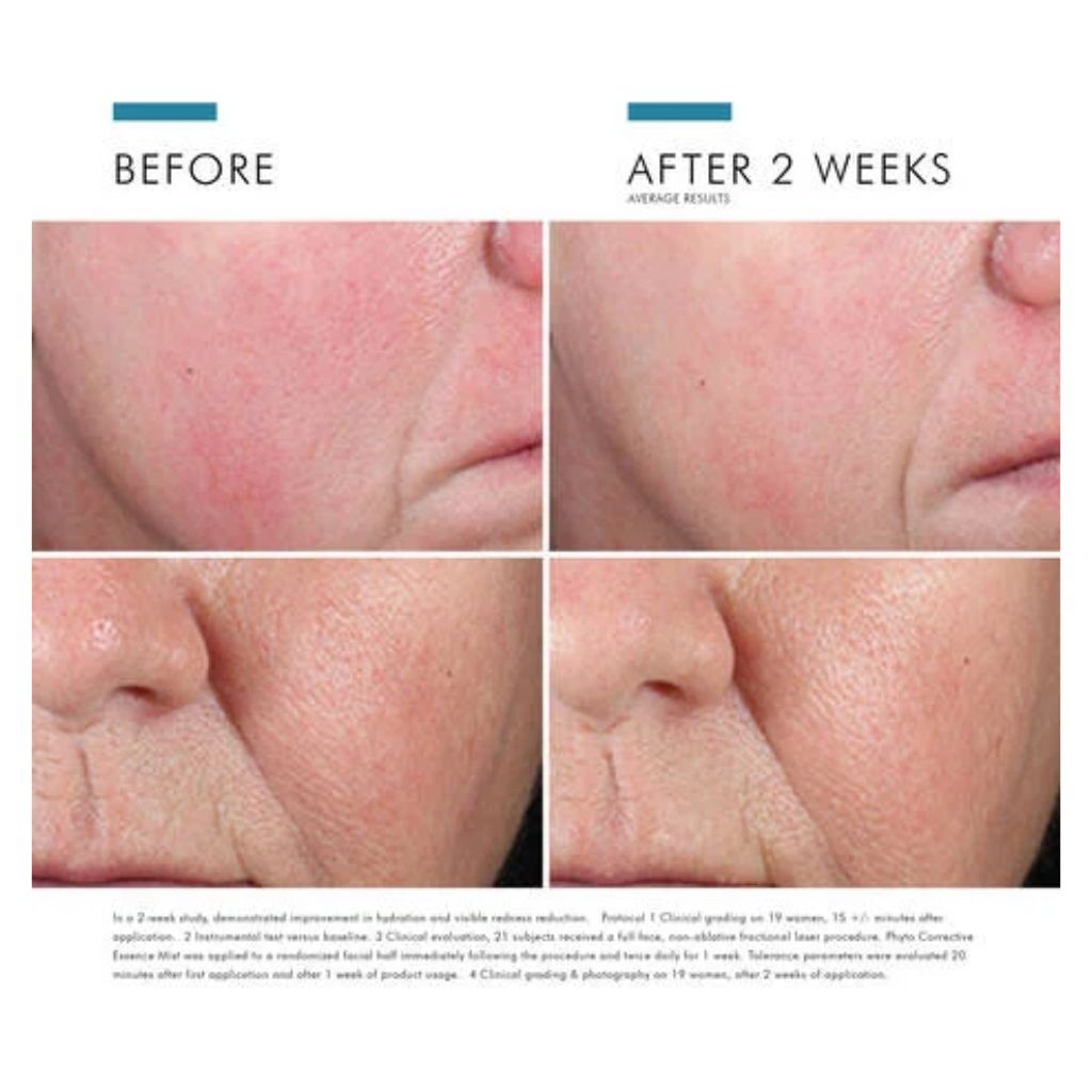 Phyto Corrective Essence Mist - Image 6