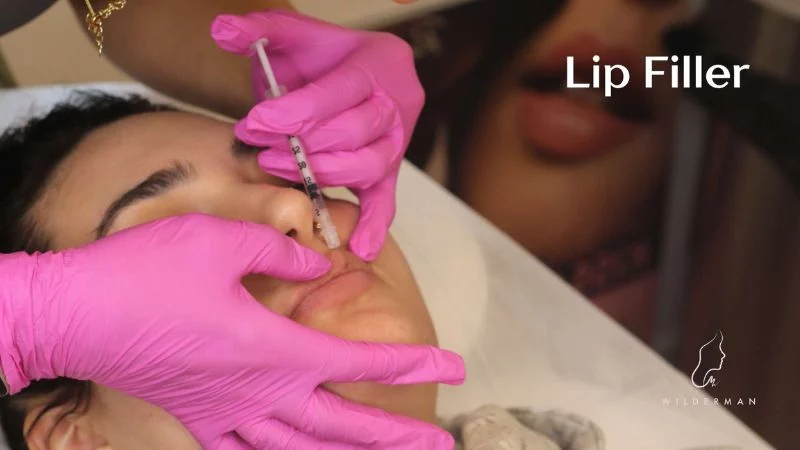Lip Fillers Injections - Wilderman Cosmetic Clinic injections